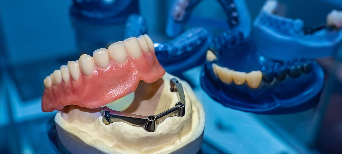 dental-Dentures