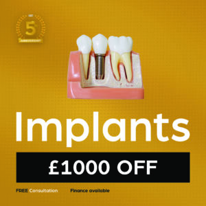 dental implants london