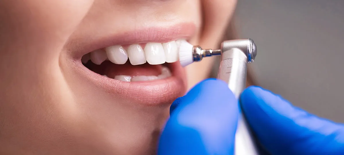 dental-hygenist-london